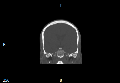 ../_images/coronal_en.png