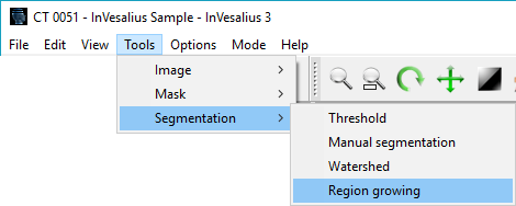 ../_images/menu_segmentation_region_growing_en.png