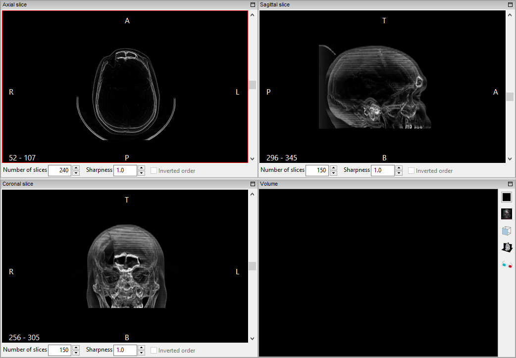 ../_images/multiplanar_window_contour_maxip_en.png