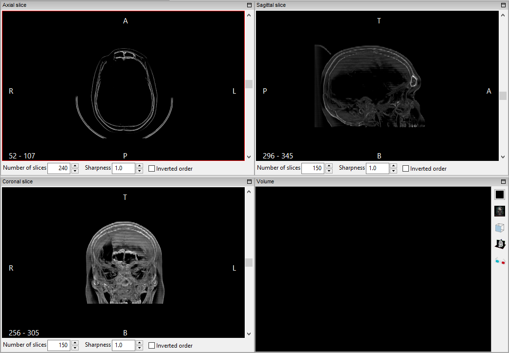 ../_images/multiplanar_window_contour_mida_en.png