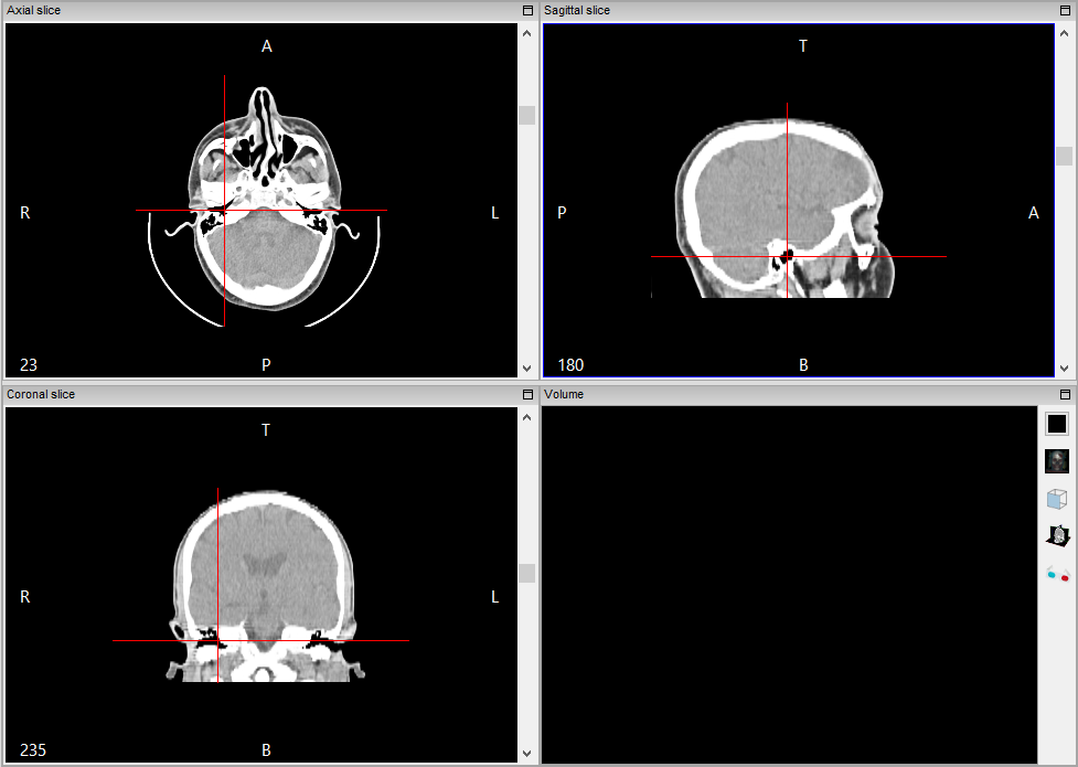 ../_images/multiplanar_window_cross_en.png