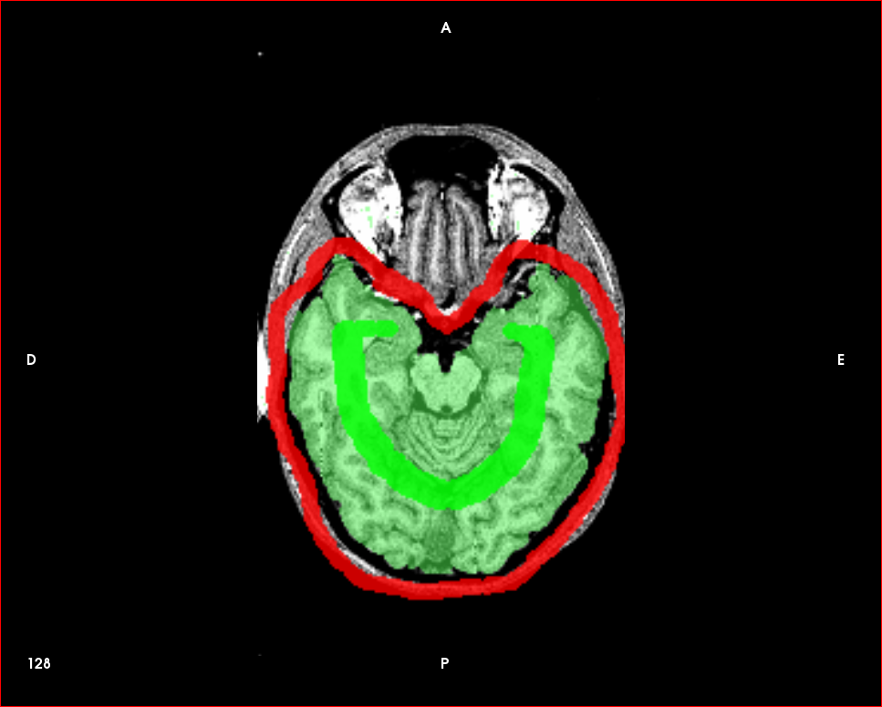 ../_images/segmentation_watershed_axial.png